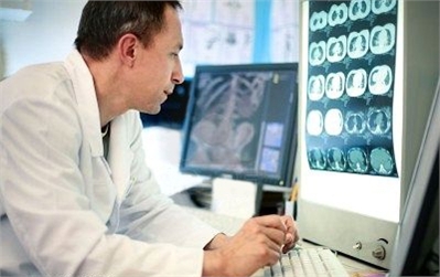 Picture of a male Physician looking at ct scan results.