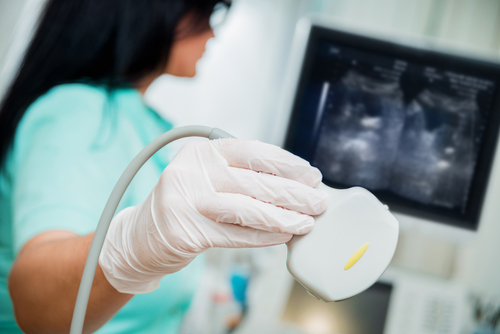 Picture of an Ultrasound Tech holding up a transducer that she is about to use for an ultrasound. There is a sonogram up on the screen.