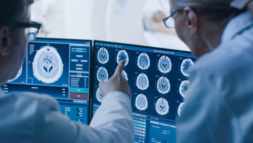 Picture of two radiologist looking at two screens of x-rays on the brain MRI scan.